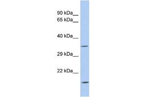 WB Suggested Anti-ASPDH Antibody Titration: 0. (ASPDH Antikörper  (Middle Region))