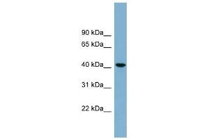 B4GALT2 antibody used at 1 ug/ml to detect target protein. (B4GALT2 Antikörper  (Middle Region))