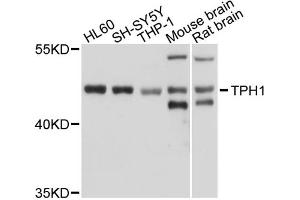 Western blot analysis of extracts of various cell lines, using TPH1 antibody (ABIN5970750) at 1/1000 dilution. (Tryptophan Hydroxylase 1 Antikörper)