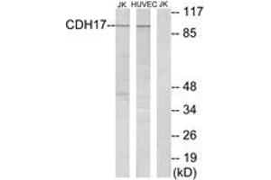 Western blot analysis of extracts from Jurkat/HuvEc cells, using CDH17 Antibody. (LI Cadherin Antikörper  (AA 341-390))
