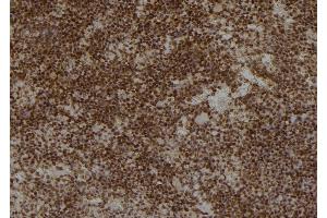 Immunohistochemistry (IHC) image for anti-Aldo-Keto Reductase Family 1, Member C3 (3-alpha Hydroxysteroid Dehydrogenase, Type II) (AKR1C3) antibody (ABIN6259862)