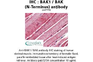 Image no. 2 for anti-BCL2-Antagonist/killer 1 (BAK1) (N-Term) antibody (ABIN1732215) (BAK1 Antikörper  (N-Term))
