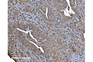 IHC analysis of REA/PHB2 using anti-REA/PHB2 antibody (ABIN7599239). (Prohibitin 2 Antikörper  (AA 1-299))