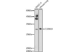 Western blot analysis of extracts of various cell lines, using CLDN18 antibody (ABIN6127701, ABIN6138681, ABIN6138682 and ABIN6224437) at 1:1000 dilution. (Claudin 18 Antikörper  (AA 20-80))