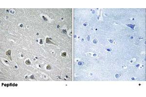 Immunohistochemistry analysis of paraffin-embedded human brain tissue using MYLIP polyclonal antibody . (MYLIP Antikörper)