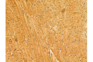 anti-Lactamase, beta 2 (LACTB2) (Internal Region) antibody