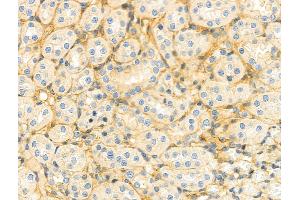 ABIN6263092 and ABIN6276728 at 1/100 staining Rat kidney tissue by IHC-P.