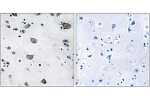 Immunohistochemistry (IHC) image for anti-Apoptosis-Inducing Factor, Mitochondrion-Associated, 3 (AIFM3) (AA 10-59) antibody (ABIN2889860) (AIFM3 Antikörper  (AA 10-59))