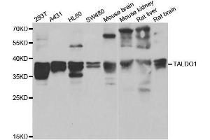 Western blot analysis of extracts of various cell lines, using TALDO1 antibody. (TALDO1 Antikörper  (AA 1-337))