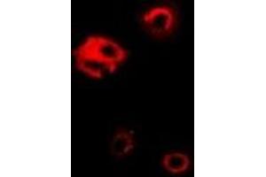 Immunofluorescent analysis of PGK1 staining in Hela cells.