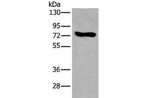 Western blot analysis of NIH/3T3 cell lysate using KEAP1 Polyclonal Antibody at dilution of 1:600 (KEAP1 Antikörper)