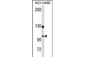 DLG Antibody (N-term) (ABIN1539122 and ABIN2850094) western blot analysis in NCI- cell line lysates (35 μg/lane).