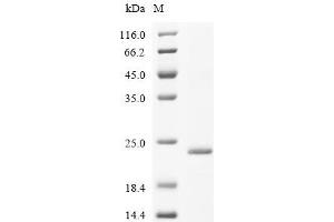 Claudin 3 (CLDN3) (AA 1-218), (full length) protein (His tag)