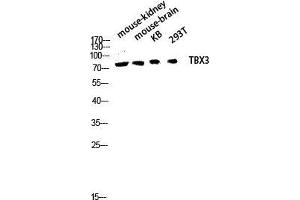 Western Blot (WB) analysis of Mouse Kidney Mouse Brain KB 293T lysis using TBX3 antibody. (TBX3 Antikörper  (Internal Region))