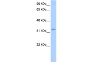 Western Blotting (WB) image for anti-Nuclear Receptor Interacting Protein 2 (NRIP2) antibody (ABIN2463362) (NRIP2 Antikörper)