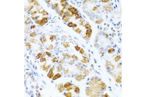 Immunohistochemistry of paraffin-embedded human stomach using BMP3 antibody (ABIN5975705) at dilution of 1/100 (40x lens). (BMP3 Antikörper)