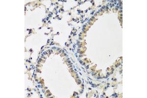 Immunohistochemistry of paraffin-embedded mouse lung using BMP2 antibody. (BMP2 Antikörper)