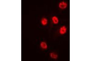 Immunofluorescent analysis of Histone Deacetylase 1 staining in HeLa cells. (HDAC1 Antikörper  (C-Term))