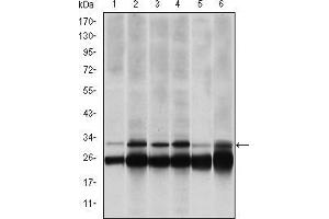 Western blot analysis using PSMB8 mouse mAb against Hela (1), MCF-7 (2), A431 (3), RAJI (4), MOTL4 (5) and PC-12 (6) cell lysate. (PSMB8 Antikörper)