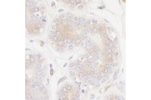 Immunohistochemistry (IHC) image for anti-Protein Tyrosine Phosphatase G1 (PTPN12) (AA 499-780) antibody (ABIN7453983) (Rekombinanter PTPN12 Antikörper  (AA 499-780))