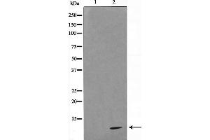 Western blot analysis on HeLa cell lysate using COX17 Antibody,The lane on the left is treated with the antigen-specific peptide. (COX17 Antikörper  (N-Term))
