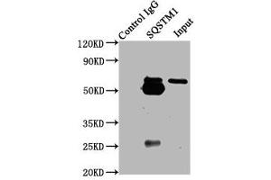 Immunoprecipitating SQSTM1 in Hela whole cell lysate Lane 1: Rabbit control IgG (1 μg) instead of ABIN7168871 in Hela whole cell lysate. (SQSTM1 Antikörper  (AA 16-310))