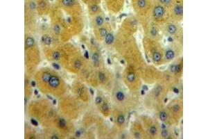 Used in DAB staining on fromalin fixed paraffin-embedded Liver tissue (CAMKII gamma Antikörper  (AA 75-281))