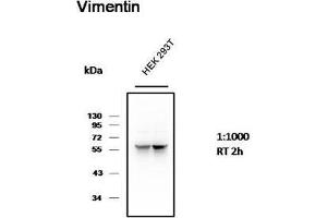 Western Blot (WB) analysis of 293T cell with Mouse Monoclonal Antibody diluted at 1:1000. (Vimentin Antikörper)