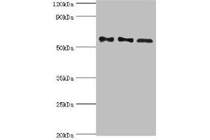 PPP3CC Antikörper  (Catalytic Subunit gamma)