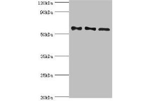 Western blot All lanes: Serine/threonine-protein phosphatase 2B catalytic subunit gamma isoform antibody at 10 μg/mL Lane 1: Rat brain tissue Lane 2: MCF-7 whole cell lysate Lane 3: Rat skeletal muscle tissue Secondary Goat polyclonal to rabbit IgG at 1/10000 dilution Predicted band size: 59, 58, 60 kDa Observed band size: 59 kDa (PPP3CC Antikörper  (Catalytic Subunit gamma))