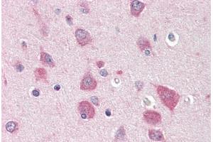 Human Brain, Cortex (formalin-fixed, paraffin-embedded) stained with MYO5B antibody ABIN396915 at 20 ug/ml followed by biotinylated goat anti-rabbit IgG secondary antibody ABIN481713, alkaline phosphatase-streptavidin and chromogen. (MYO5B Antikörper  (C-Term))