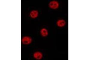 ABIN6277090 staining Hela by IF/ICC. (POLR2A/RPB1 Antikörper  (Internal Region))