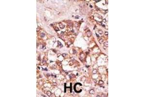 Immunohistochemistry (IHC) image for anti-BCL2-Interacting Killer (Apoptosis-Inducing) (BIK) (BH3 Domain) antibody (ABIN2997206) (BIK Antikörper  (BH3 Domain))