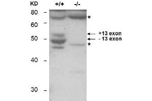 Western Blotting (WB) image for anti-Bridging Integrator 1 (BIN1) antibody (ABIN1043740) (BIN1 Antikörper)