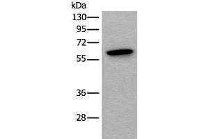 Western blot analysis of Mouse testis tissue lysate using SCP2 Polyclonal Antibody at dilution of 1:350 (SCP2 Antikörper)