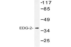Image no. 1 for anti-Lysophosphatidic Acid Receptor 1 (LPAR1) antibody (ABIN317688) (LPAR1 Antikörper)