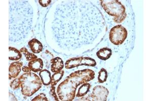 Immunohistochemistry (IHC) image for anti-Cadherin-16 (CDH16) (AA 371-507) antibody (ABIN6939022)