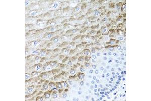 Immunohistochemistry of paraffin-embedded human esophagus using F3 antibody at dilution of 1:100 (x40 lens). (Tissue factor Antikörper)