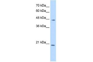 WB Suggested Anti-PAX6 Antibody Titration:  0. (PAX6 Antikörper  (N-Term))