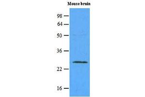 Western blot analysis: The extracts of mouse brain (45ug) were resolved by SDS-PAGE, transferred to NC membrane and probed with anti-human Rab5a (1:500). (RAB5 Antikörper)