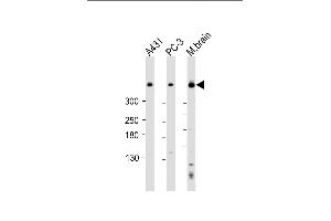 All lanes : Anti-DYNC1H1 Antibody (C-term) at 1:2000 dilution Lane 1: A431 whole cell lysate Lane 2: PC-3 whole cell lysate Lane 3: mouse brain lysate Lysates/proteins at 20 μg per lane. (DYNC1H1 Antikörper  (C-Term))