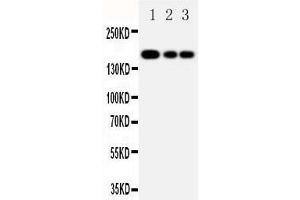 Anti-MRP1 antibody, Western blotting Lane 1: JURKAT Cell Lysate Lane 2: CEM Cell Lysate Lane 3: A549 Cell Lysate (ABCC1 Antikörper  (C-Term))