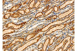 ABIN6265692 and ABIN6276452 at 1/100 staining Rat kidney tissue by IHC-P. (TPMT Antikörper  (N-Term))