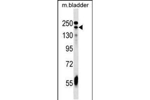 Western blot analysis in mouse bladder tissue lysates (35ug/lane). (ADCY9 Antikörper  (C-Term))