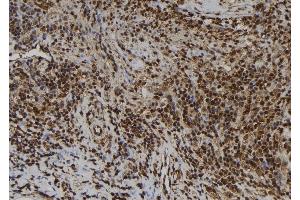 ABIN6259844 and ABIN6277505 at 1/100 staining Human spleen tissue by IHC-P.