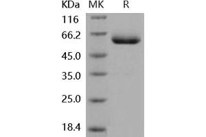 Western Blotting (WB) image for Coxsackie Virus and Adenovirus Receptor (CXADR) (Active) protein (His tag,Fc Tag) (ABIN7320435) (Coxsackie Adenovirus Receptor Protein (His tag,Fc Tag))