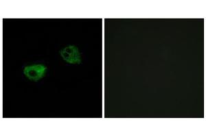 Immunofluorescence analysis of HepG2 cells, using MTR1A antibody. (Melatonin Receptor 1A Antikörper  (Internal Region))