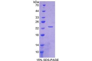 Image no. 1 for Interleukin 1 alpha (IL1A) (AA 101-270) protein (His tag) (ABIN6237678) (IL1A Protein (AA 101-270) (His tag))