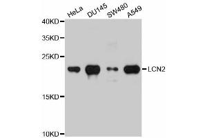 Western blot analysis of extracts of various cell lines, using LCN2 antibody (ABIN5971118) at 1/1000 dilution. (Lipocalin 2 Antikörper)