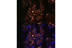 Immunofluorescence (IF) image for anti-Low Density Lipoprotein Receptor-Related Protein 8, Apolipoprotein E Receptor (LRP8) (C-Term) antibody (ABIN6143337)